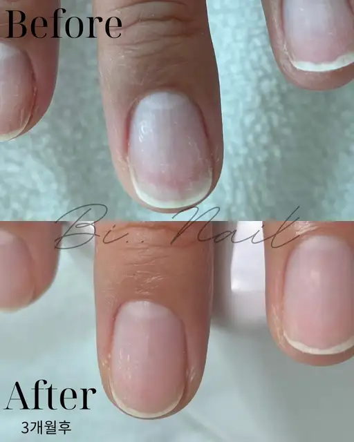 Bi..Nail 사진 2