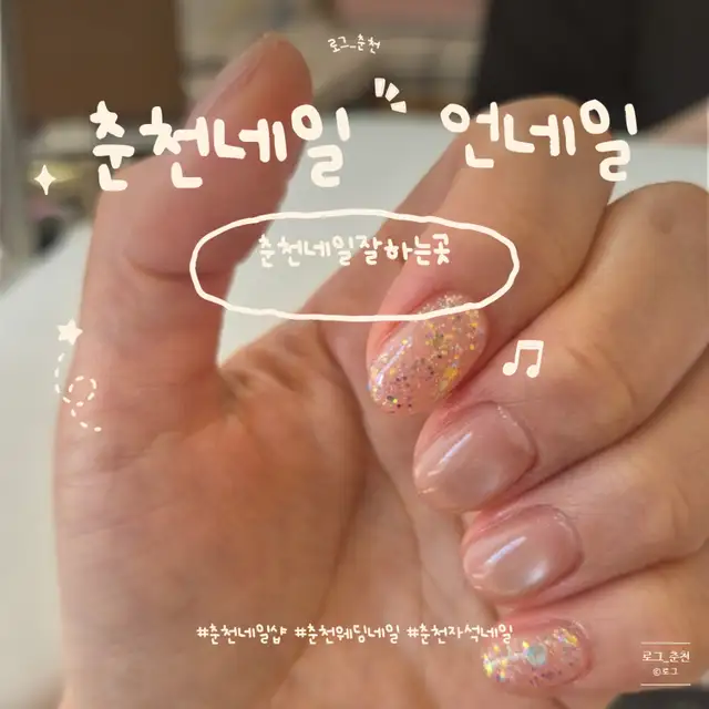 언네일 사진 3