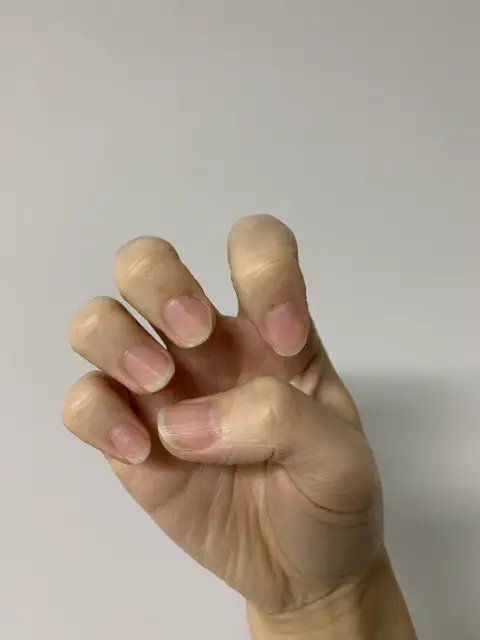 비오네일 사진 2