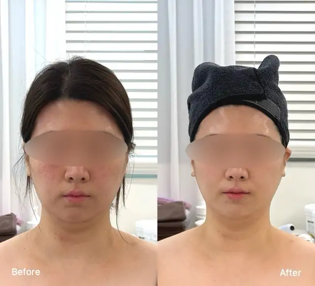 유얼핏 에스테틱 사진 5