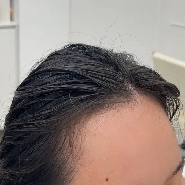 버니헤어 사진 5