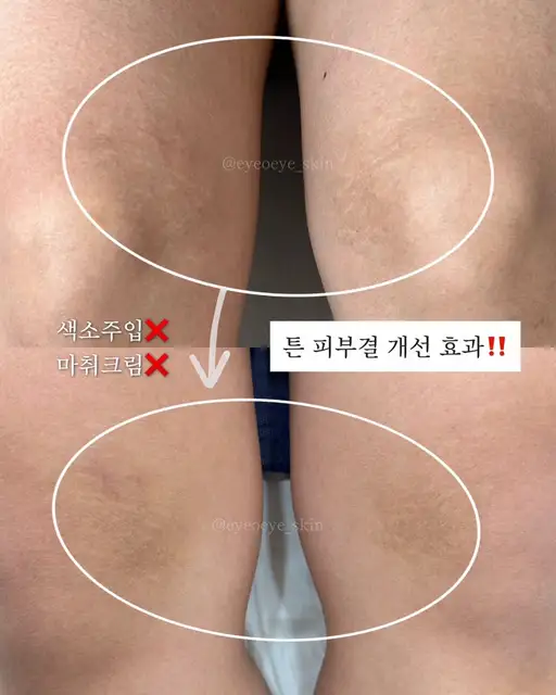 아이오아이스킨 사진 6