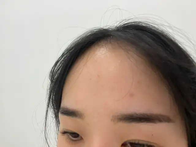 이소에스테틱 사진 7