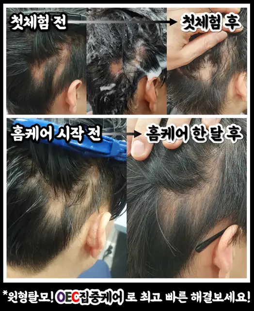 하루헤어뜰 사진 2