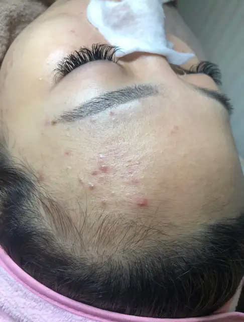 윤스킨 사진 7