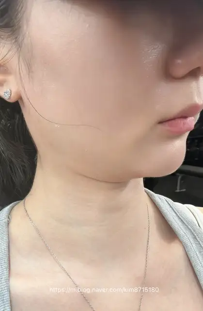 피오라엘 테라피 사진 3
