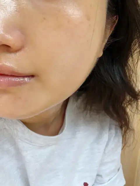 오글로시 사진 4