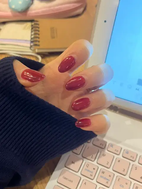 하얀손톱 사진 4