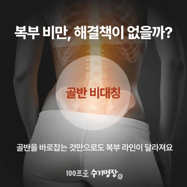 에스 사진 1