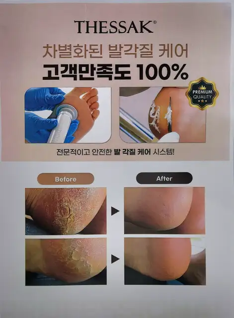 솜슈가링 사진 2