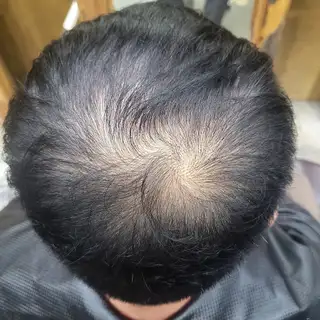 헤어칸지 사진