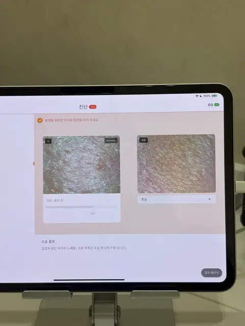대담에스테틱 사진 7