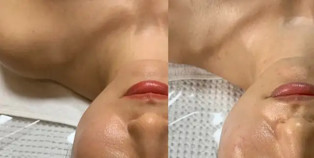 오지뷰티 사진 7