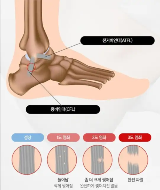 솔라테스 사진 4