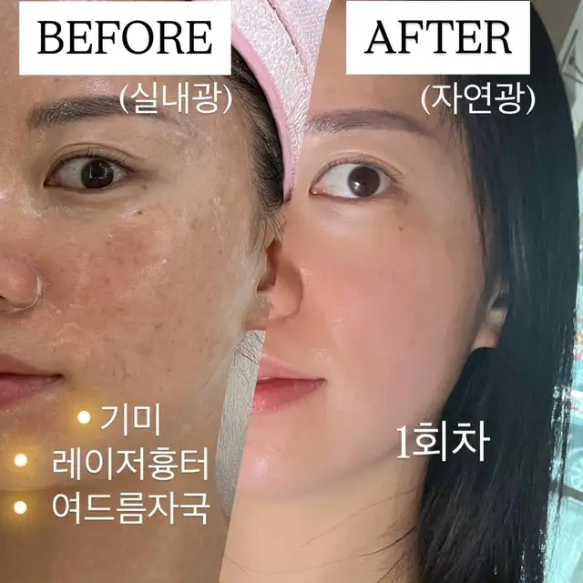 기노혀니피부관리실 사진 7