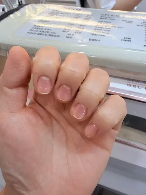 오투네일 사진 8