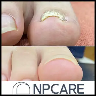 NP케어 부산서면점 사진