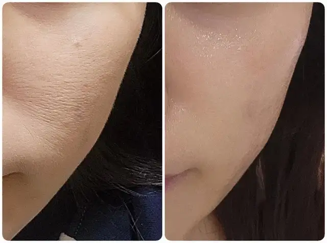 피네스테틱 사진 5