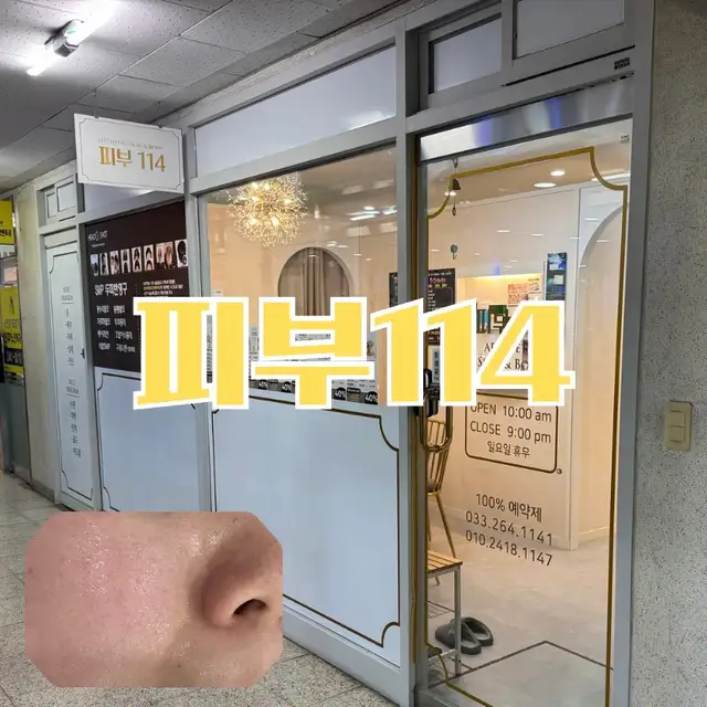 피부114 사진 3