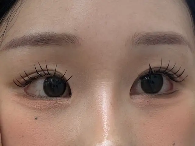 아뮤어래쉬 사진 6