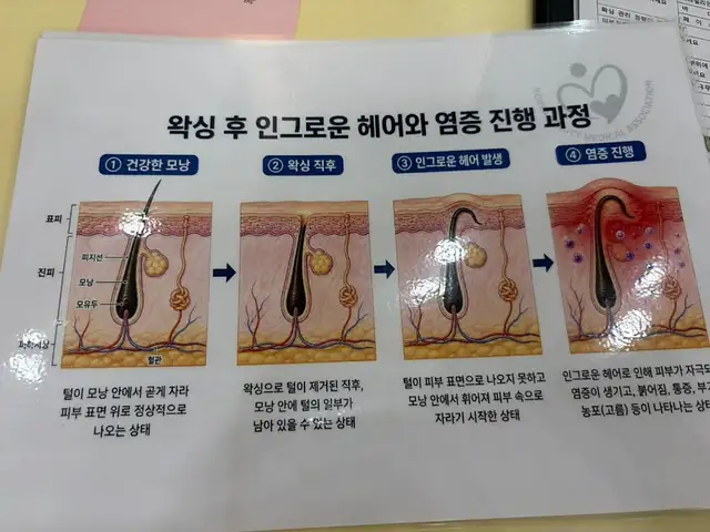 푸른달왁싱 동탄본점 사진 6