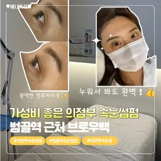브로우백 사진