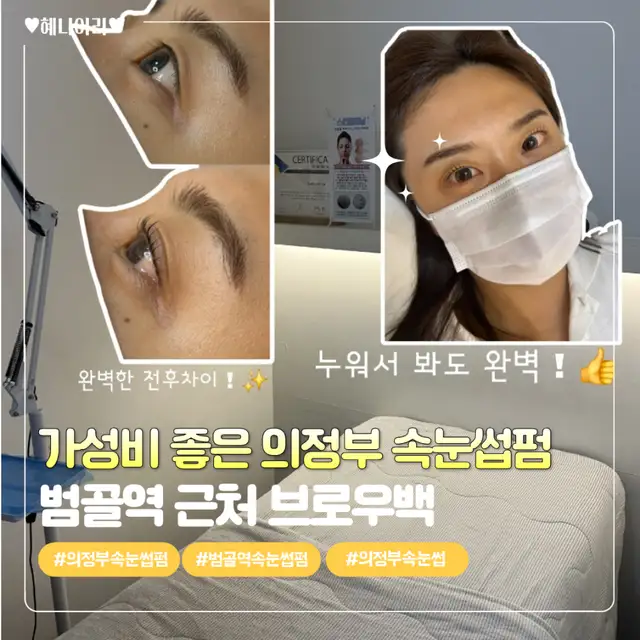 브로우백 사진 1