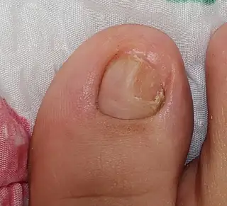 태은, 네일 사진