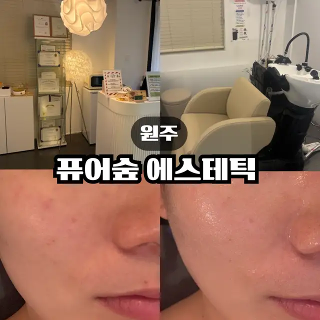 퓨어숲에스테틱 사진 7