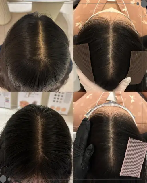 모스테틱 사진 3