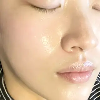 탈모락바이피부수작 사진