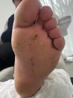 푸스케어 서면부전점 핑풋 사진