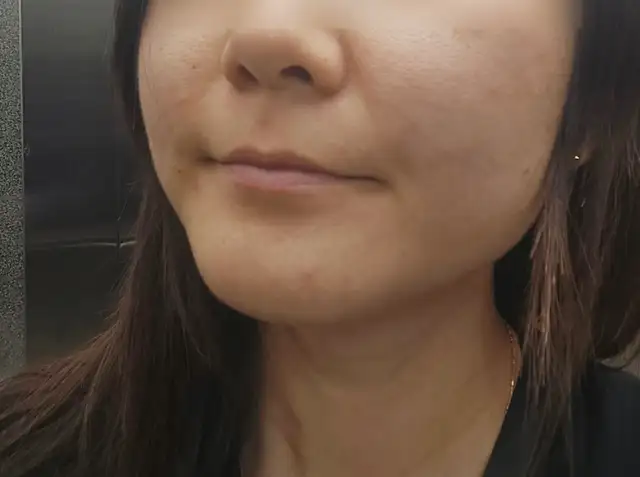 스킨바이윤 사진 3