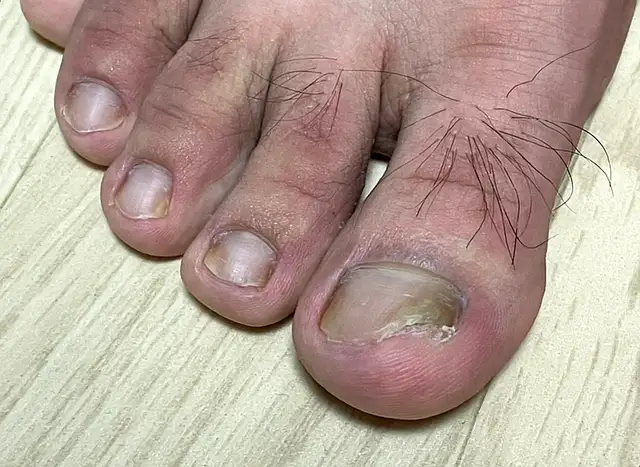 NP케어 부산서면점 사진 4