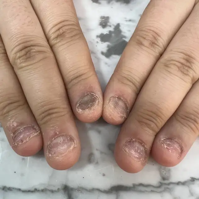 공감네일 사진 1