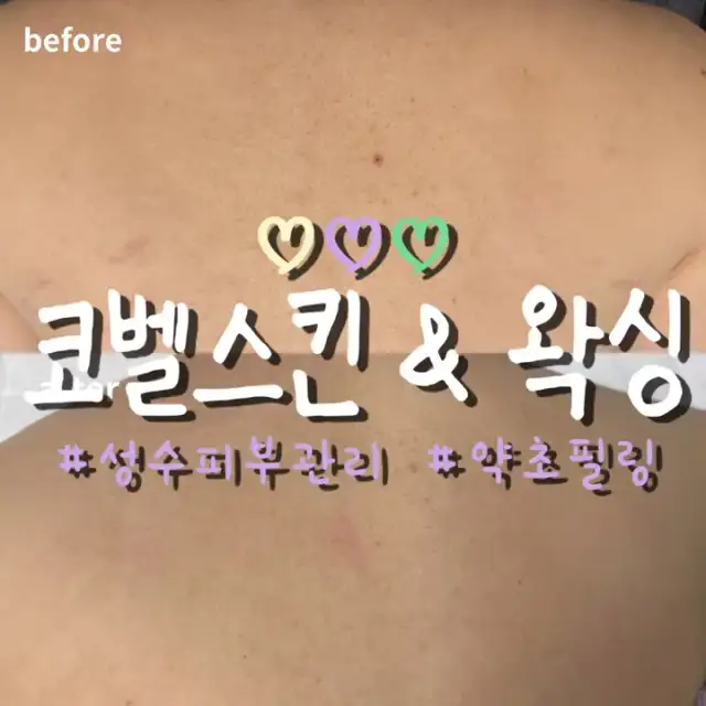 코벨스킨 사진 5