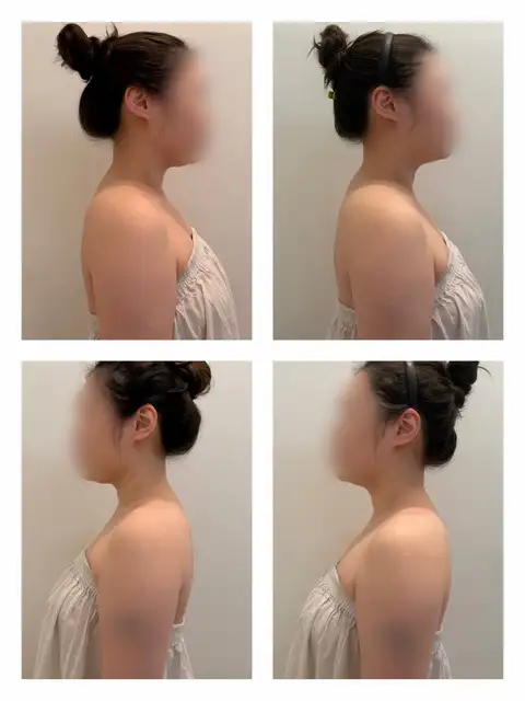 커스텀진에스테틱 사진 3