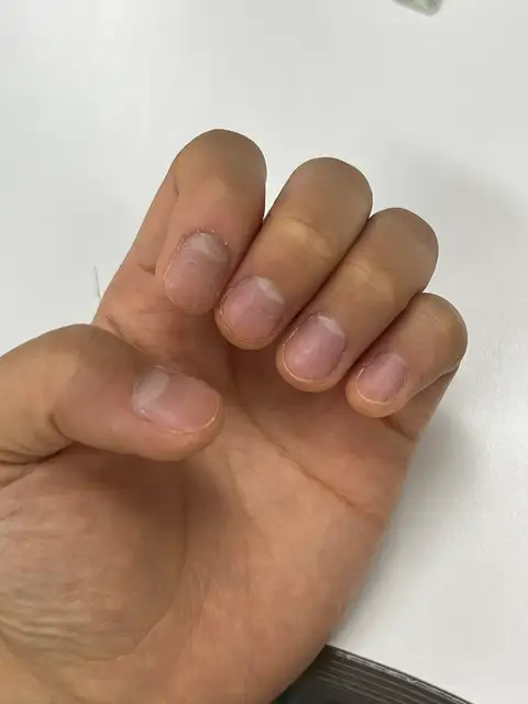 네일, 히리 사진 2