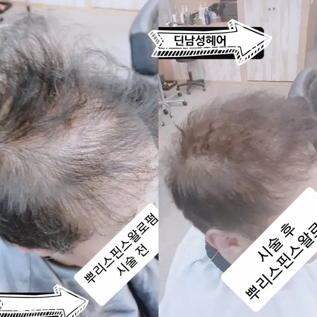 딘남성헤어 사진 1