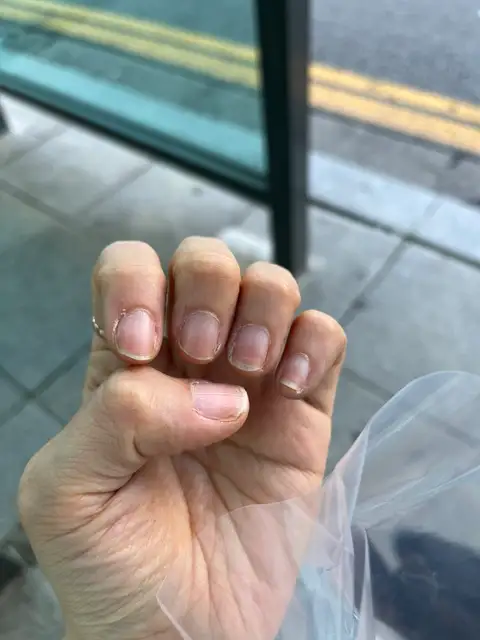 엠에스네일 사진 8