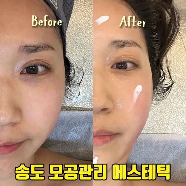 안스에스테틱 사진 2