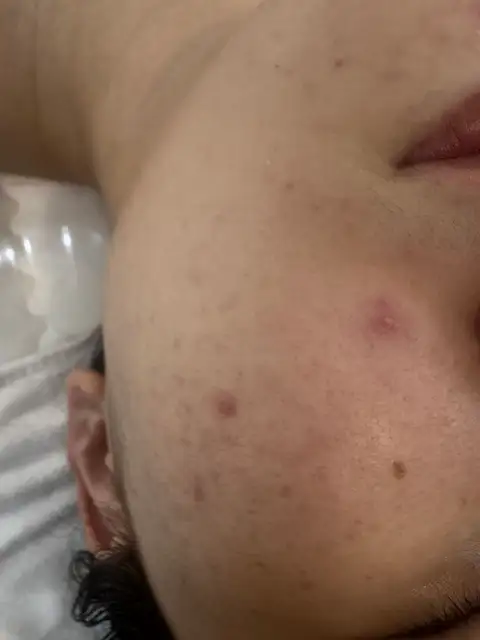 피치피치 사진 7