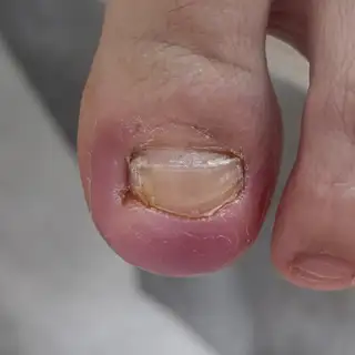 메디푸스 사진