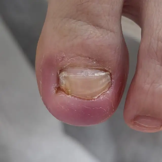 메디푸스 사진 1