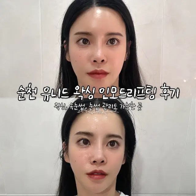유니드왁싱 사진 7