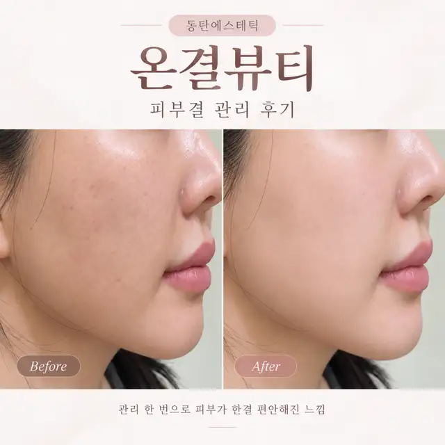 온결뷰티 사진 5
