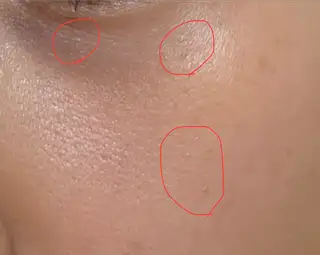디어브로우 청라눈썹&셀핏바디피부 사진