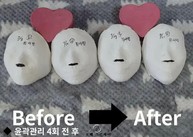보떼스킨케어 사진 7