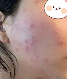 헤라에스테틱 사진
