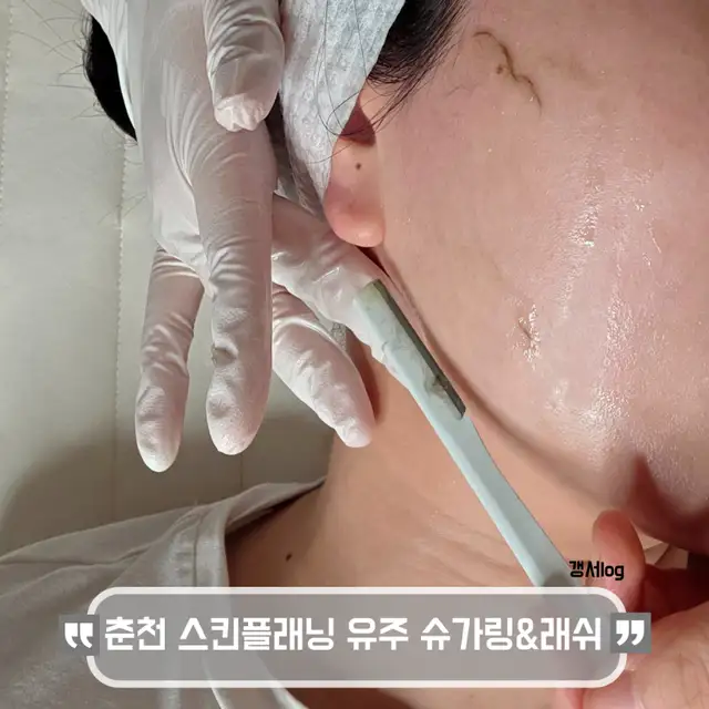 유주 슈가링&래쉬 사진 3